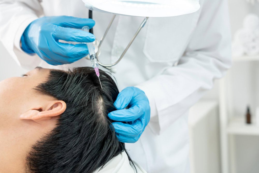 ein-mannlicher-patient-der-sich-einer-prp-behandlung-in-einer-deutschen-haarklinik-unterzieht