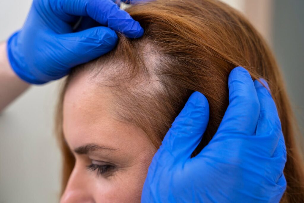 vor-der-haartransplantation-lasst-eine-frau-ihr-haar-in-einer-klinik-in-deutschland-untersuchen