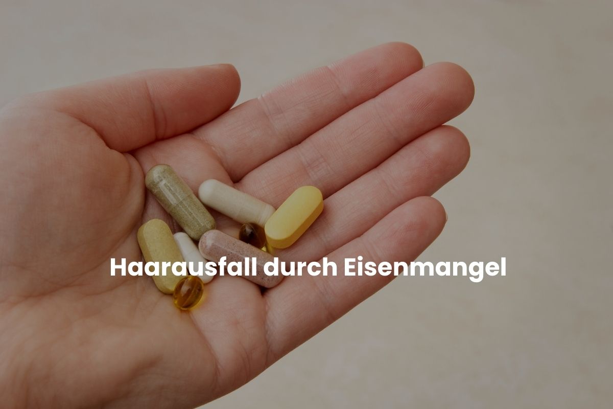 Haarausfall durch Eisenmangel