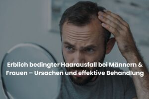 erblich bedingter Haarausfall
