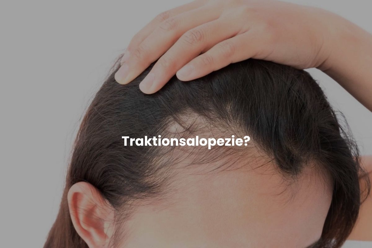 Traktionsalopezie