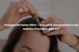 Frauen mit hoher Stirn – was sind die Ursachen und welche Lösungen gibt es