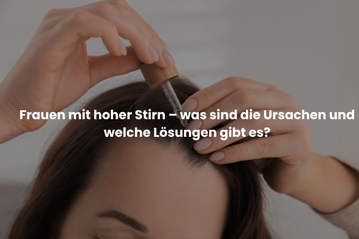 Frauen mit hoher Stirn – was sind die Ursachen und welche Lösungen gibt es