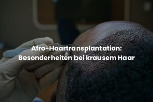 Afro-Haartransplantation: Besonderheiten bei krausem Haar