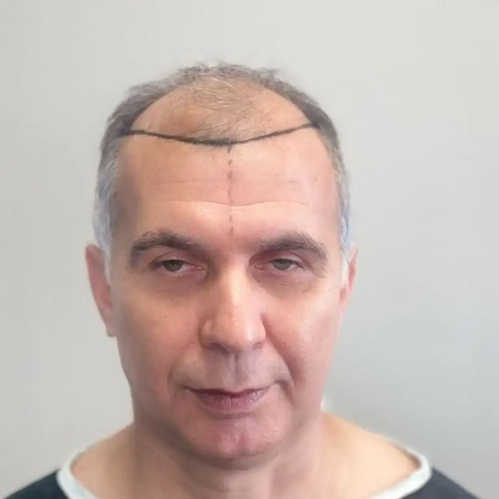 After-Fotograf1 After-Fotograf1