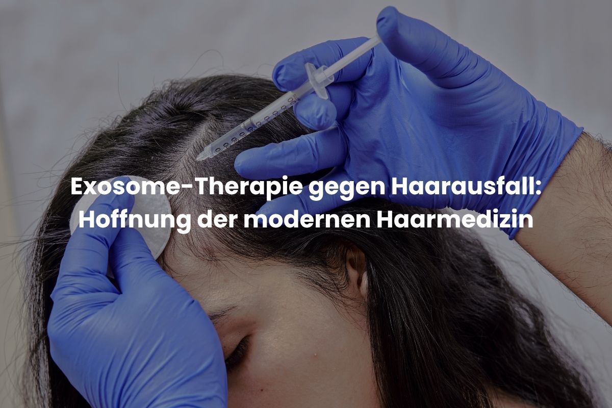 Exosome-Therapie gegen Haarausfall: Hoffnung der modernen Haarmedizin