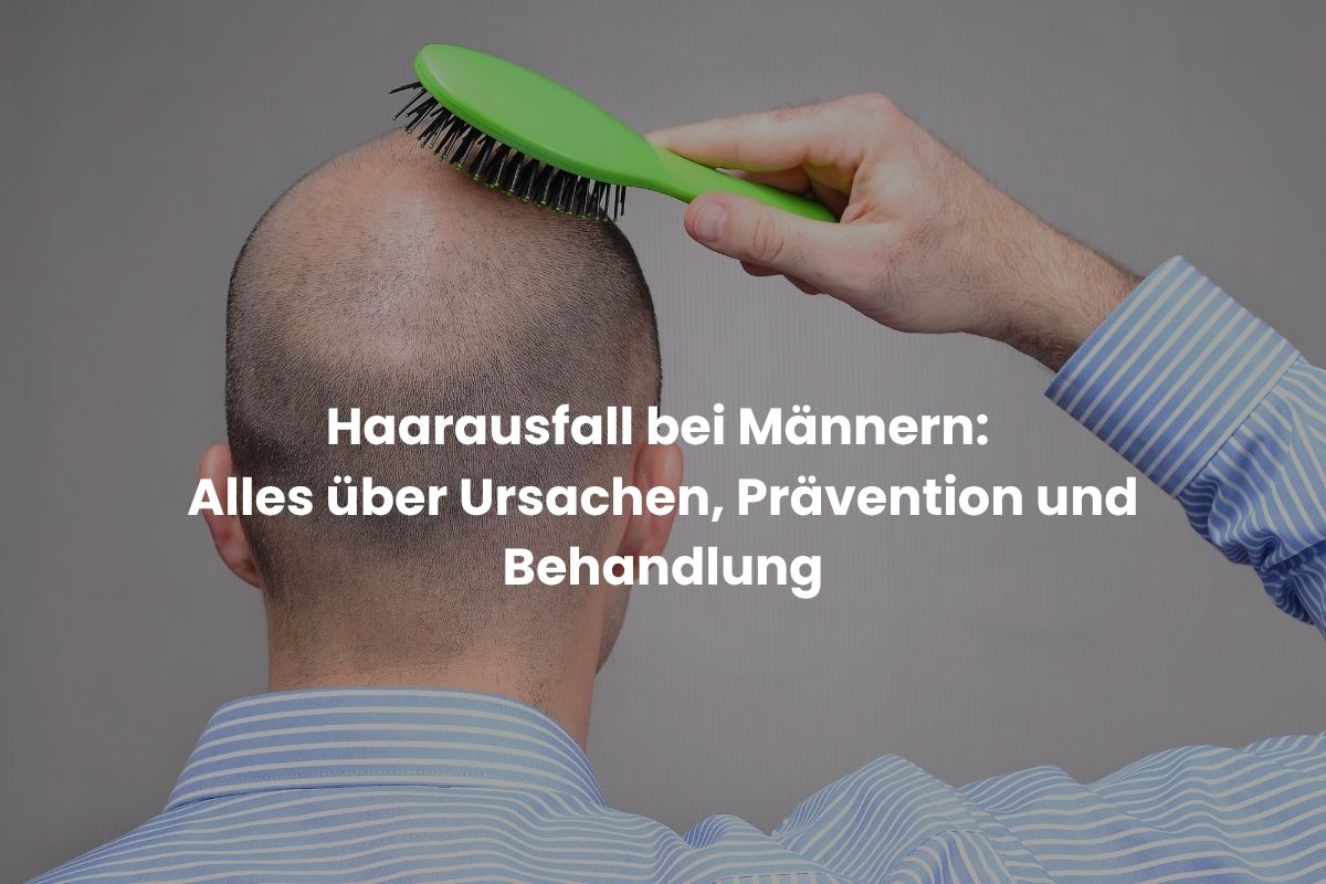 Haarausfall bei Männern: Alles über Ursachen, Prävention und Behandlung