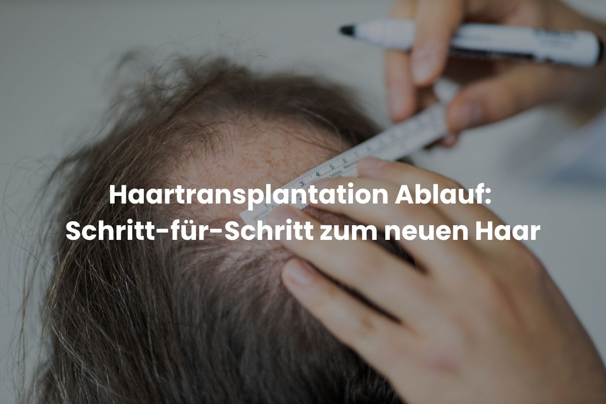 Haartransplantation Ablauf: Schritt-für-Schritt zum neuen Haar