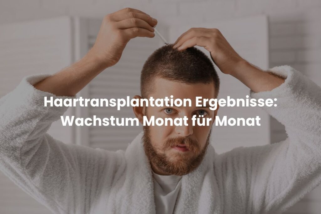 Haartransplantation Ergebnisse: Wachstum Monat für Monat