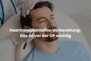 Haartransplantation Vorbereitung: Das ist vor der OP wichtig