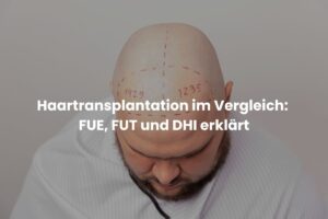 Haartransplantation im Vergleich: FUE, FUT und DHI erklärt
