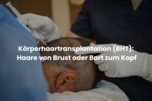 Körperhaartransplantation (BHT): Haare von Brust oder Bart zum Kopf