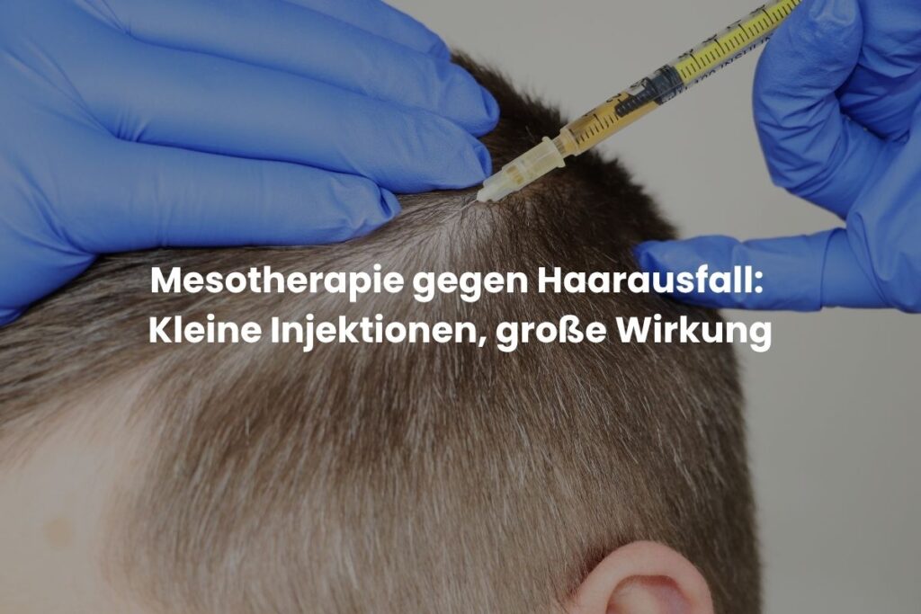 Mesotherapie gegen Haarausfall: Kleine Injektionen, große Wirkung