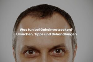 Was tun bei Geheimratsecken? Ursachen, Tipps und Behandlungen