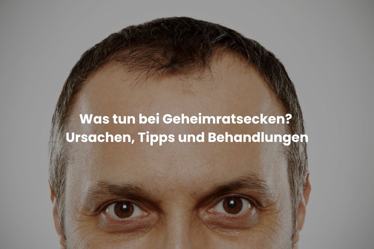 Was tun bei Geheimratsecken? Ursachen, Tipps und Behandlungen