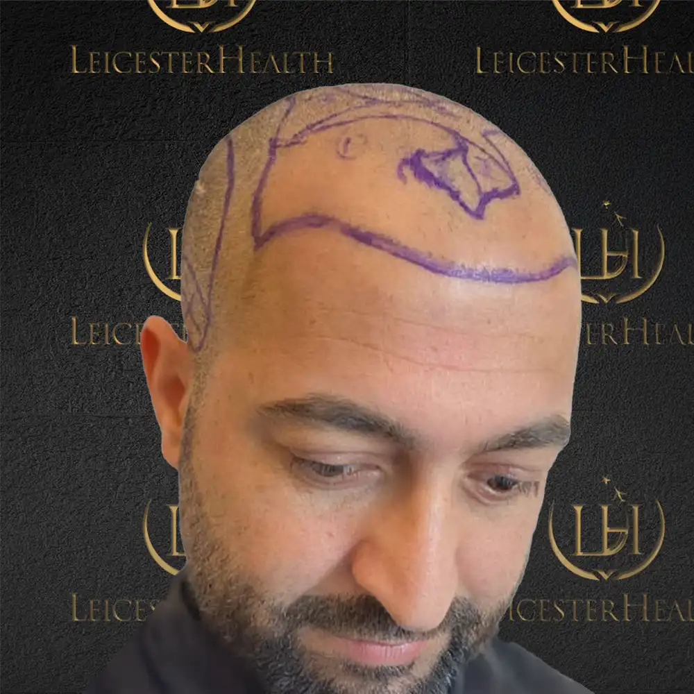 leicester health new2 leicester health new2