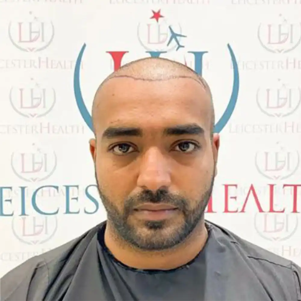 leicester health1 leicester health1