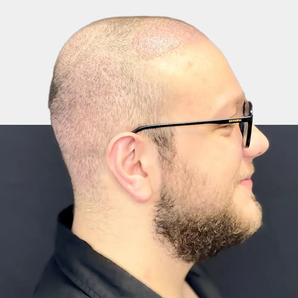 leicester health2 leicester health2