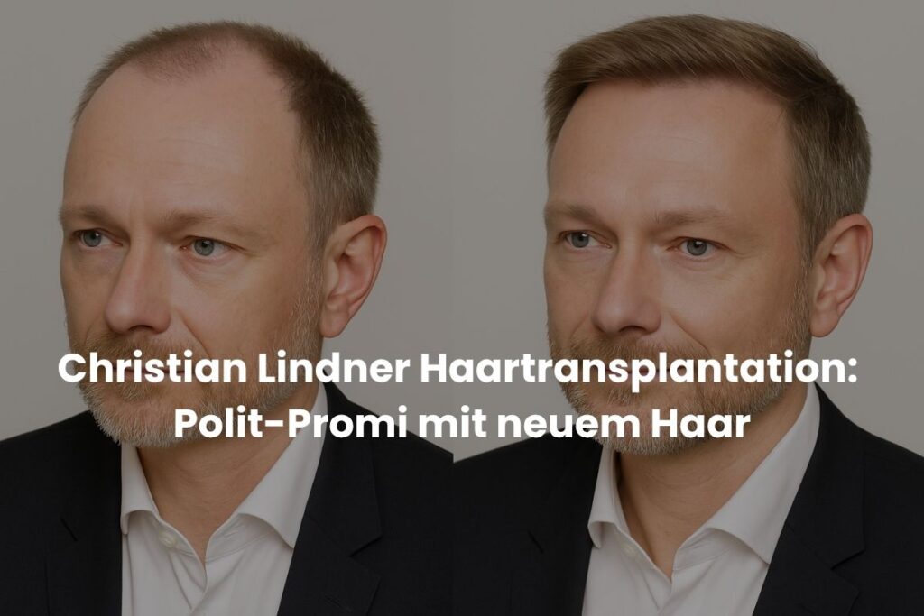 Christian Lindner Haartransplantation: Polit-Promi mit neuem Haar