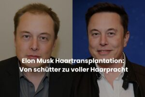 Elon Musk Haartransplantation: Von schütter zu voller Haarpracht