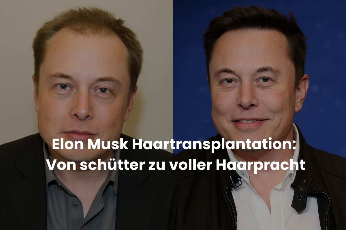 Elon Musk Haartransplantation: Von schütter zu voller Haarpracht