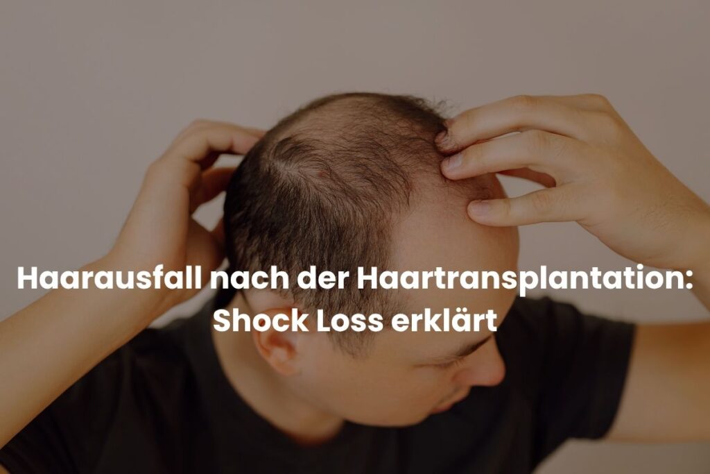 Haarausfall nach der Haartransplantation: Shock Loss erklärt