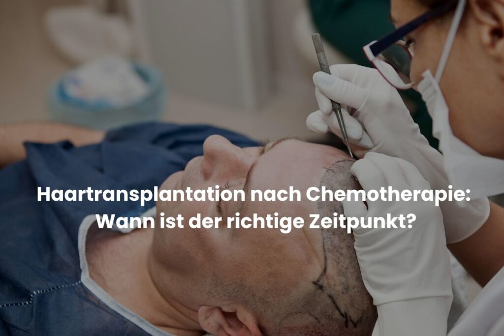 Haartransplantation nach Chemotherapie: Wann ist der richtige Zeitpunkt?