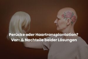 Perücke oder Haartransplantation? Vor- & Nachteile beider Lösungen ne demek