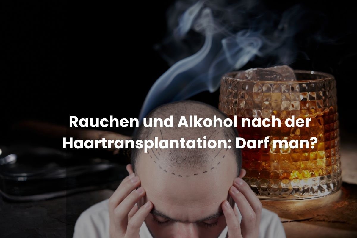 Rauchen und Alkohol nach der Haartransplantation: Darf man?