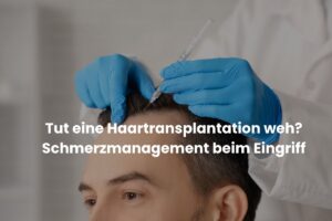 Tut eine Haartransplantation weh?
